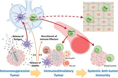 Combining energy-based focal ablation and immune checkpoint inhibitors: preclinical research and clinical trials